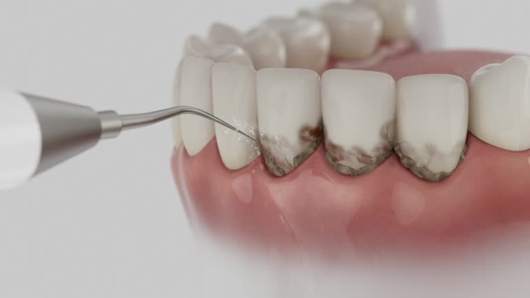 Reliable Teeth Cleaning And Checkup contractor in Moore County County, NC by Dentist Open Now